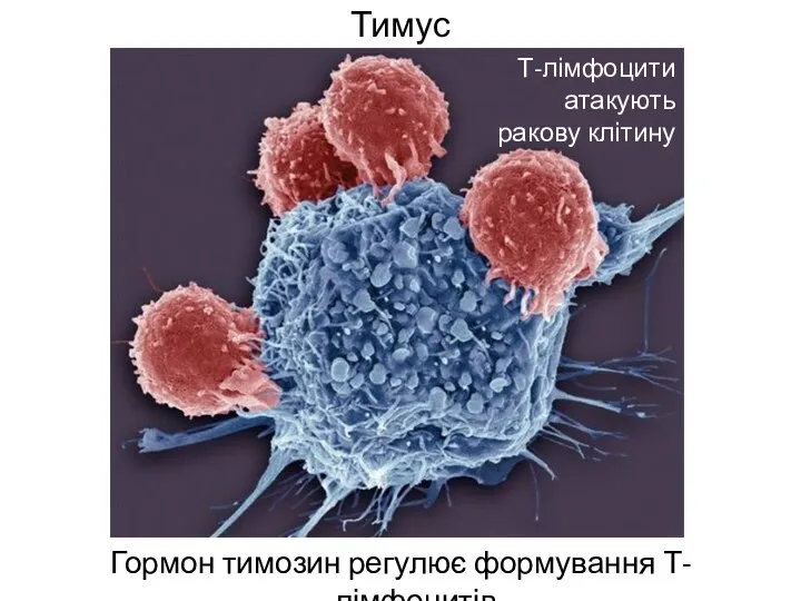 Тимус Гормон тимозин регулює формування Т-лімфоцитів Т-лімфоцити атакують ракову клітину