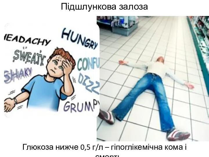 Підшлункова залоза Глюкоза нижче 0,5 г/л – гіпоглікемічна кома і смерть