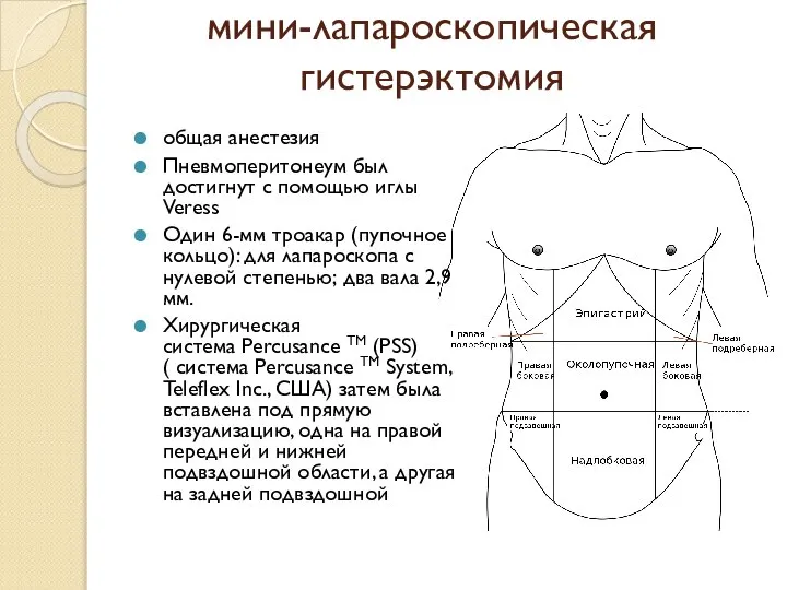 мини-лапароскопическая гистерэктомия общая анестезия Пневмоперитонеум был достигнут с помощью иглы Veress Один