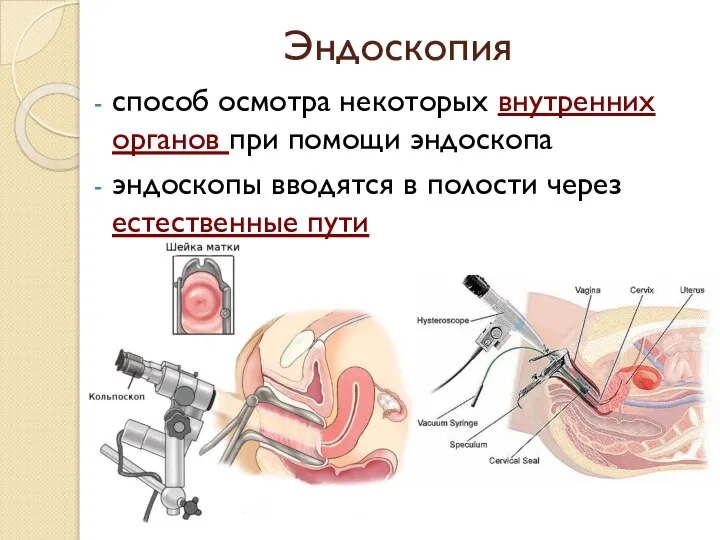 Эндоскопия способ осмотра некоторых внутренних органов при помощи эндоскопа эндоскопы вводятся в полости через естественные пути