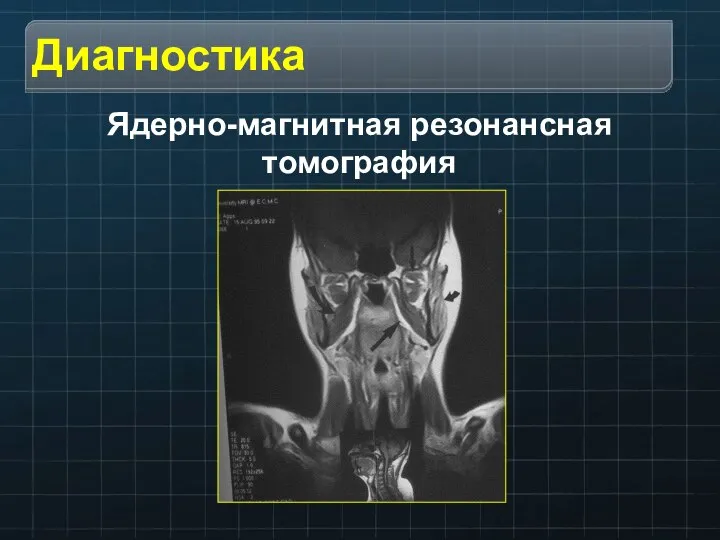 Ядерно-магнитная резонансная томография
