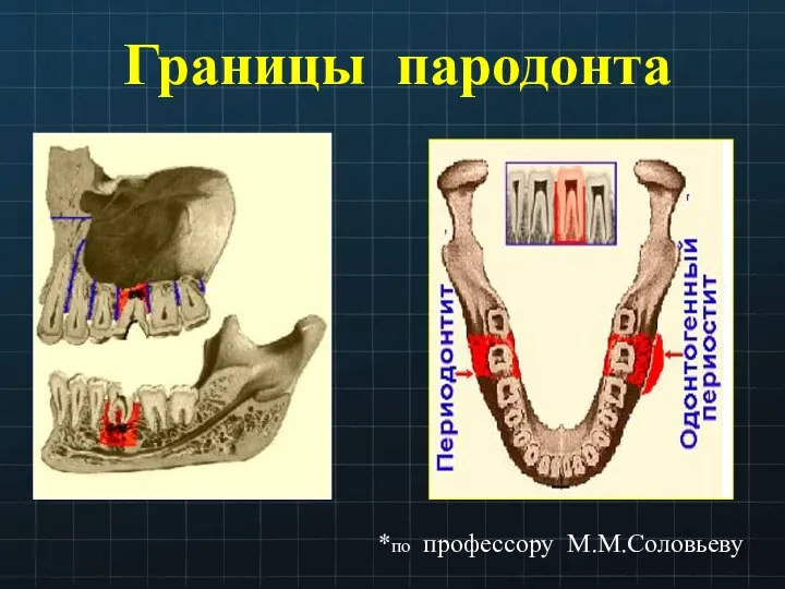 Границы пародонта *по профессору М.М.Соловьеву