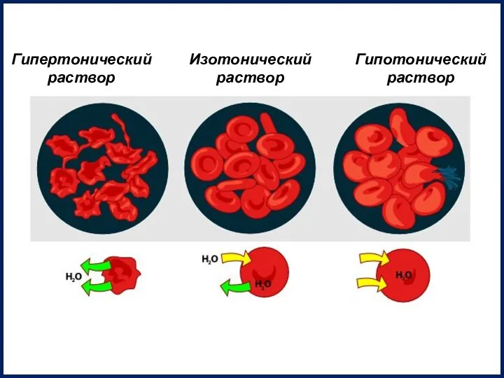 Гипертонический раствор Изотонический раствор Гипотонический раствор
