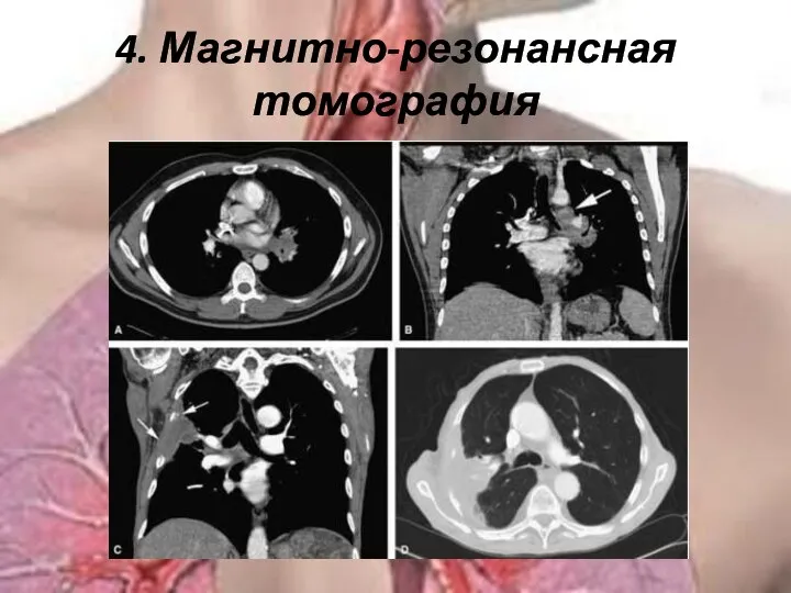 4. Магнитно-резонансная томография