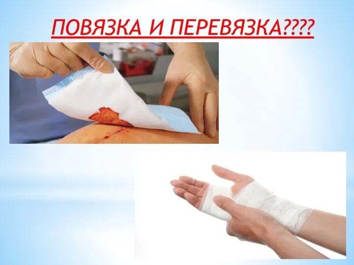 ПОВЯЗКА И ПЕРЕВЯЗКА????