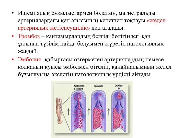 Ишемиялық бұзылыстармен болатын, магистральды артериялардағы қан ағысының кенеттен тоқтауы «жедел артериялық жетіспеушілік»