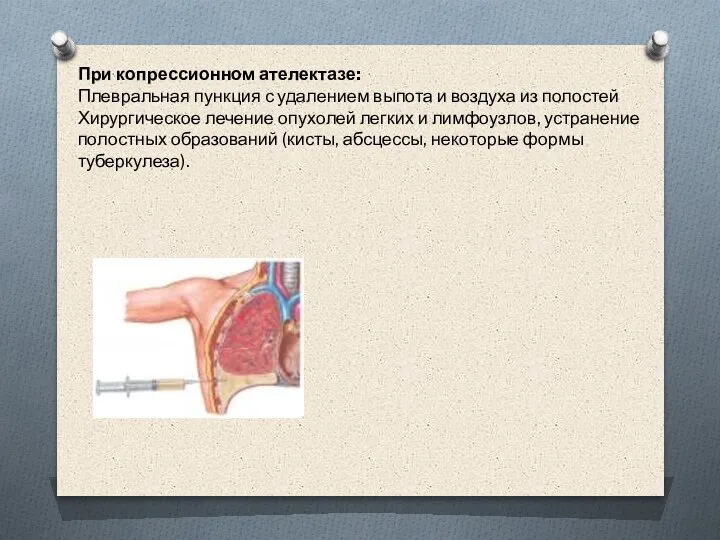 При копрессионном ателектазе: Плевральная пункция с удалением выпота и воздуха из полостей