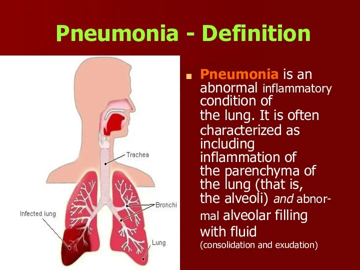 Pneumonia - D efinition Pneumonia is an abnormal inflammatory condition of the