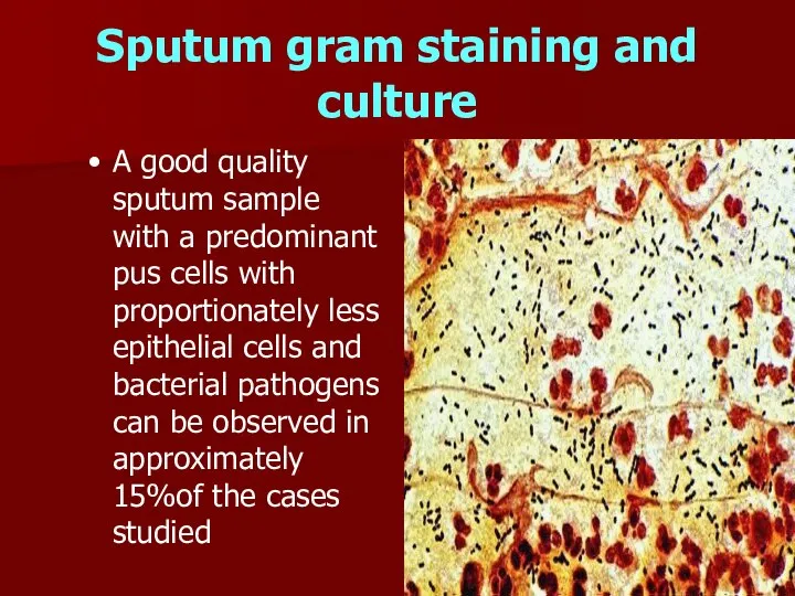Sputum gram staining and culture A good quality sputum sample with a