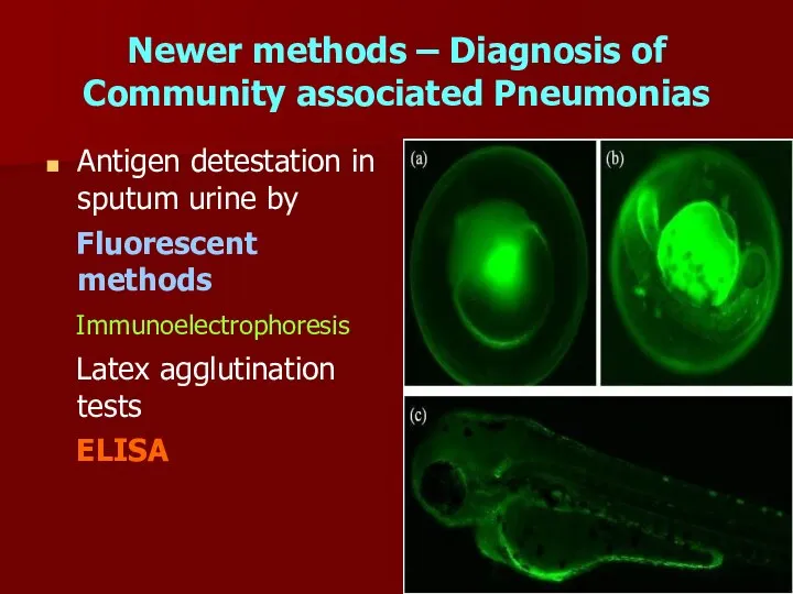 Newer methods – Diagnosis of Community associated Pneumonias Antigen detestation in sputum