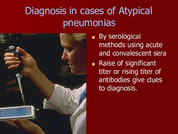 Diagnosis in cases of Atypical P neumonias By serological methods using acute