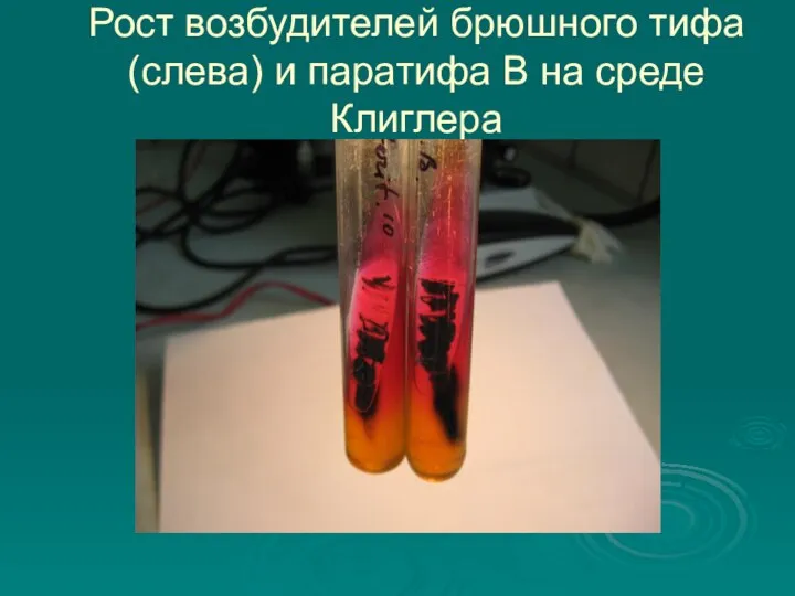 Рост возбудителей брюшного тифа (слева) и паратифа В на среде Клиглера