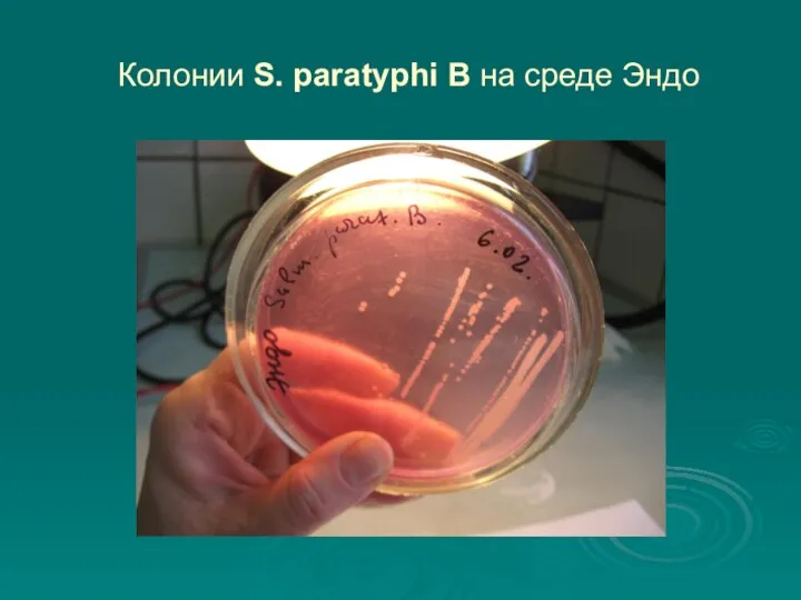 Колонии S. paratyphi B на среде Эндо