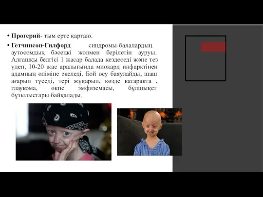 Прогерий- тым ерте қартаю. Гетчинсон-Гилфорд синдромы-балалардың аутосомдық бәсеңкі жолмен берілетін ауруы. Алғашқы