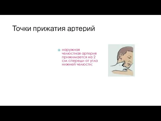 Точки прижатия артерий