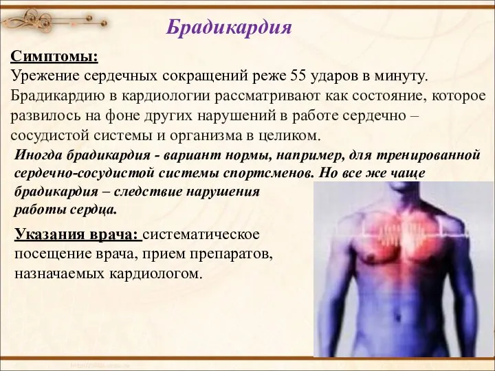 Симптомы: Урежение сердечных сокращений реже 55 ударов в минуту. Брадикардию в кардиологии