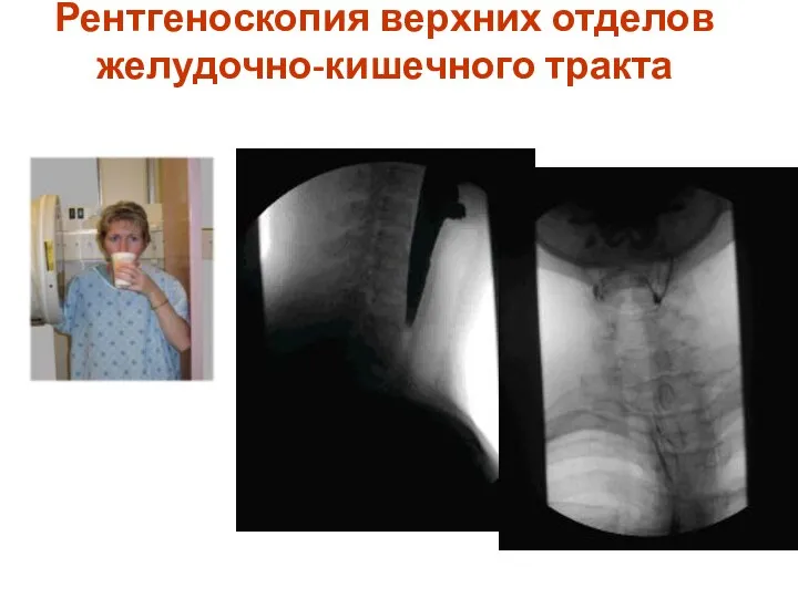 Рентгеноскопия верхних отделов желудочно-кишечного тракта