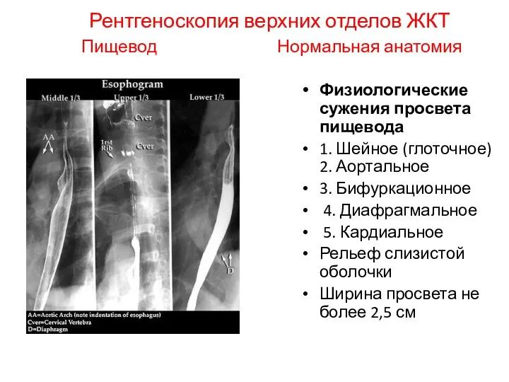 Рентгеноскопия верхних отделов ЖКТ Пищевод Нормальная анатомия Физиологические сужения просвета пищевода 1.