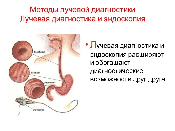 Методы лучевой диагностики Лучевая диагностика и эндоскопия Лучевая диагностика и эндоскопия расширяют