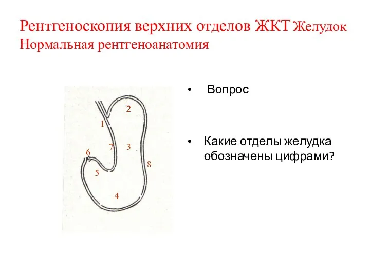 Вопрос Какие отделы желудка обозначены цифрами? Рентгеноскопия верхних отделов ЖКТ Желудок Нормальная