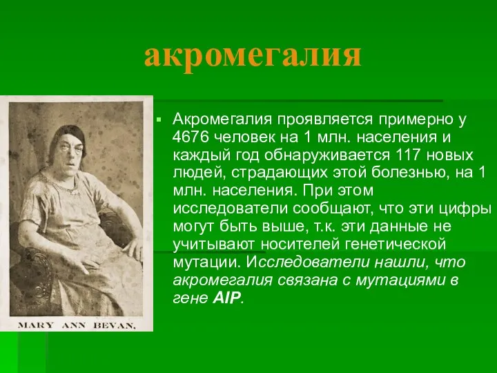 акромегалия Акромегалия проявляется примерно у 4676 человек на 1 млн. населения и