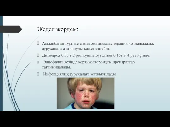 Жедел жәрдем: Асқынбаған түрінде симптоматикалық терапия қолданылады,ауруханаға жатқызуды қажет етпейді. Димедрол 0,05