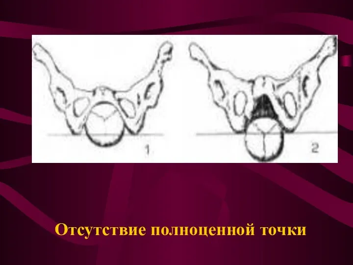 Отсутствие полноценной точки