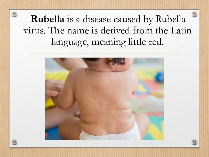 Rubella is a disease caused by Rubella virus. The name is derived