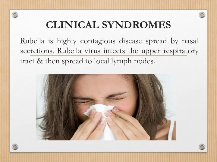 CLINICAL SYNDROMES Rubella is highly contagious disease spread by nasal secretions. Rubella