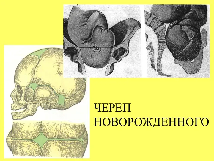 ЧЕРЕП НОВОРОЖДЕННОГО