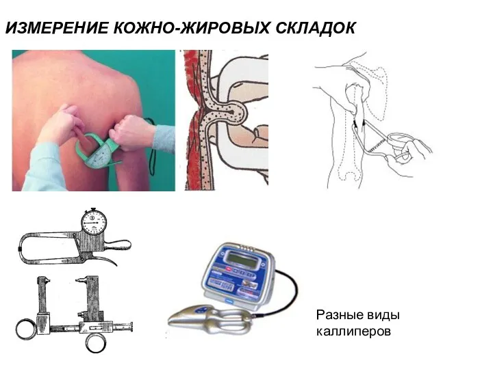 ИЗМЕРЕНИЕ КОЖНО-ЖИРОВЫХ СКЛАДОК Разные виды каллиперов