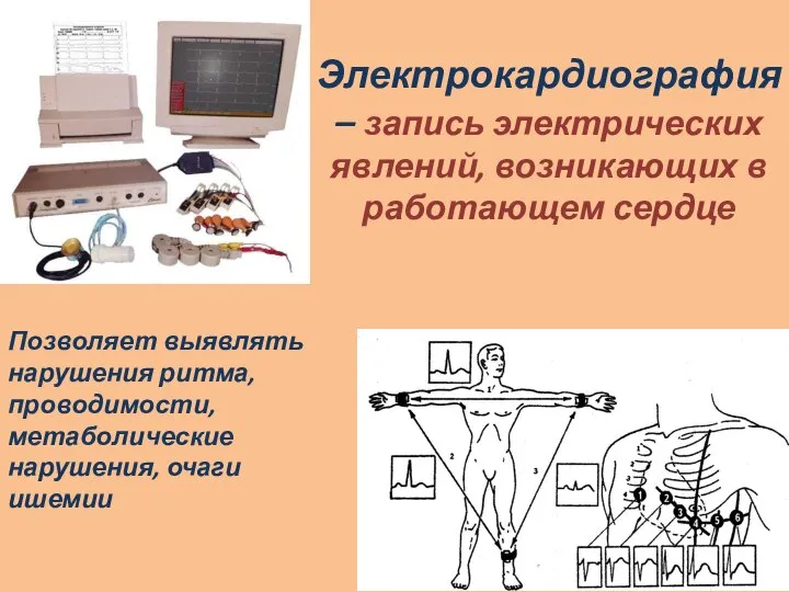 Электрокардиография – запись электрических явлений, возникающих в работающем сердце Позволяет выявлять нарушения