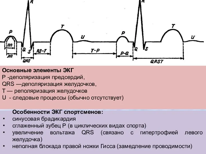 Особенности ЭКГ спортсменов: синусовая брадикардия сглаженный зубец Р (в циклических видах спорта)