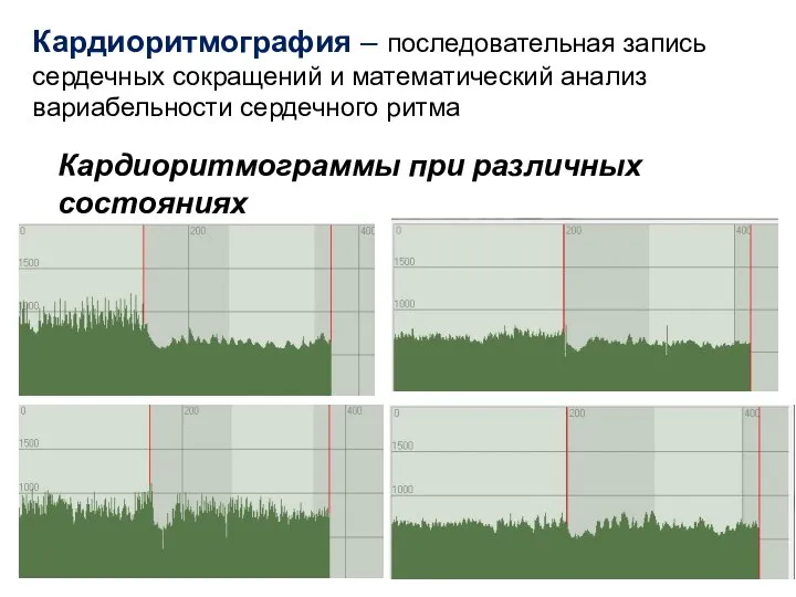 Кардиоритмограммы при различных состояниях Кардиоритмография – последовательная запись сердечных сокращений и математический анализ вариабельности сердечного ритма