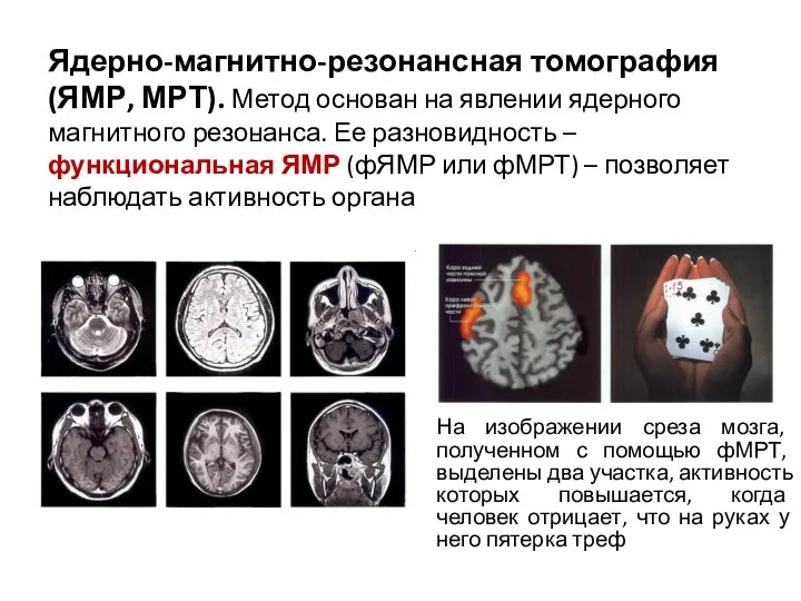 Ядерно-магнитно-резонансная томография (ЯМР, МРТ). Метод основан на явлении ядерного магнитного резонанса. Ее