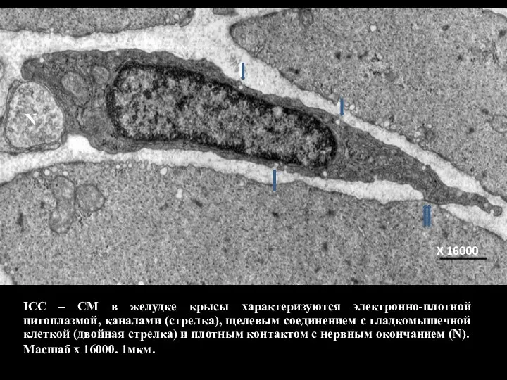 ICC – CM в желудке крысы характеризуются электронно-плотной цитоплазмой, каналами (стрелка), щелевым