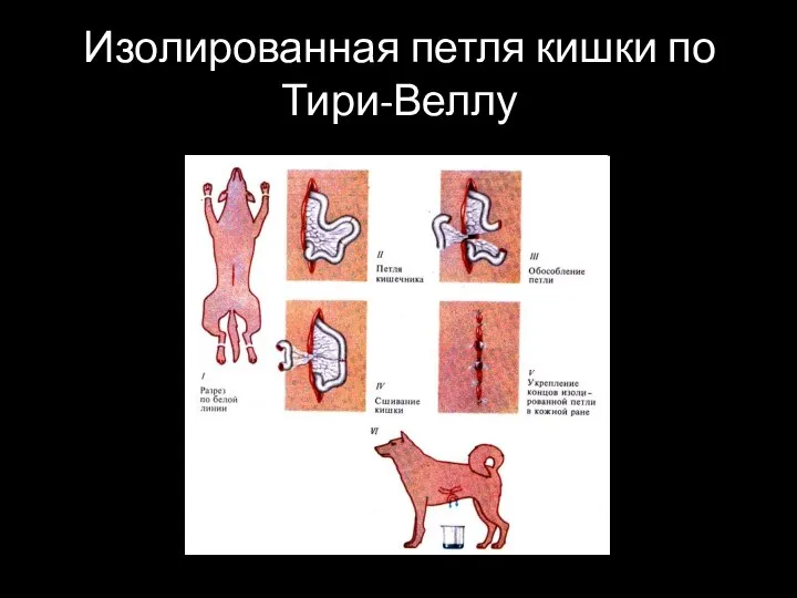 Изолированная петля кишки по Тири-Веллу