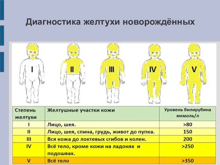 Диагностика желтухи новорождённых