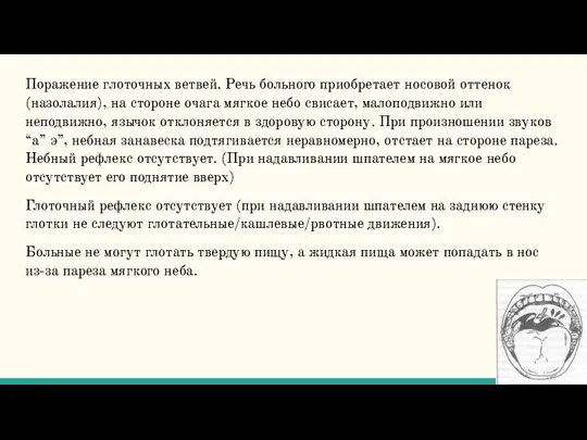 Поражение глоточных ветвей. Речь больного приобретает носовой оттенок (назолалия), на стороне очага