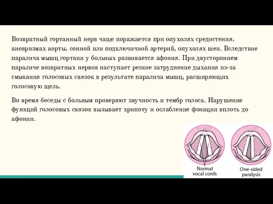 Возвратный гортанный нерв чаще поражается при опухолях средостения, аневризмах аорты, сонной или