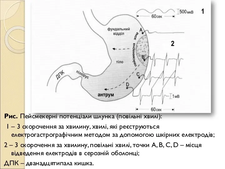 Рис. Пейсмекерні потенціали шлунка (повільні хвилі): 1 – 3 скорочення за хвилину,