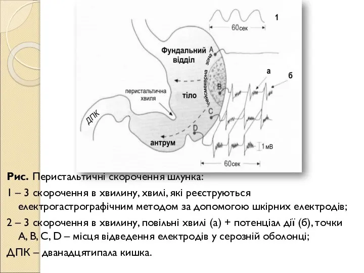 Рис. Перистальтичні скорочення шлунка: 1 – 3 скорочення в хвилину, хвилі, які