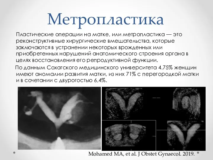 Метропластика Пластические операции на матке, или метропластика — это реконструктивные хирургические вмешательства,