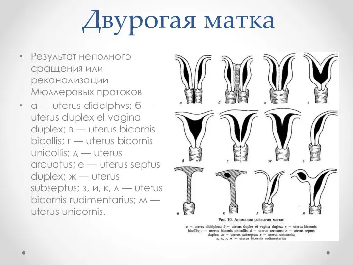 Двурогая матка Результат неполного сращения или реканализации Мюллеровых протоков а — uterus