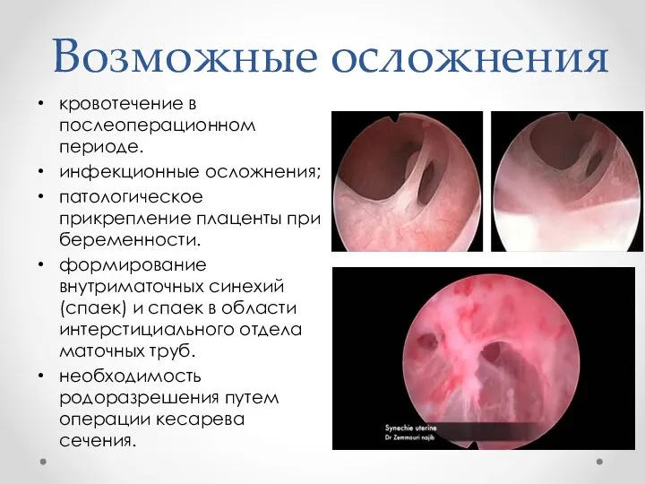 Возможные осложнения кровотечение в послеоперационном периоде. инфекционные осложнения; патологическое прикрепление плаценты при