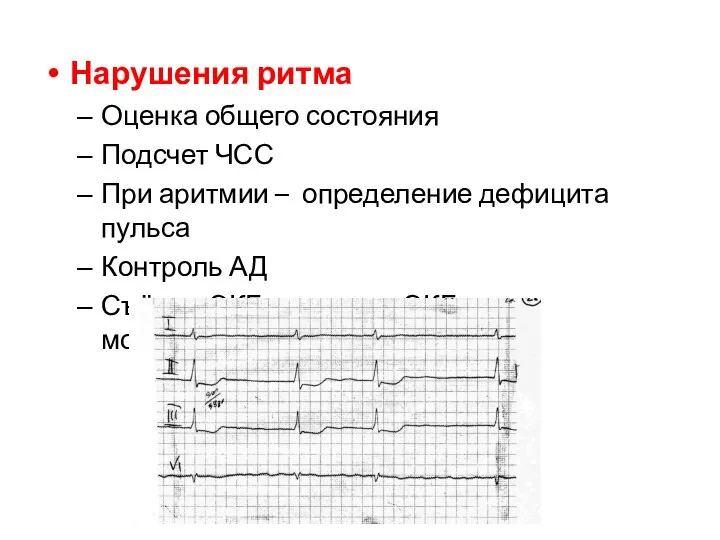 Нарушения ритма Оценка общего состояния Подсчет ЧСС При аритмии – определение дефицита