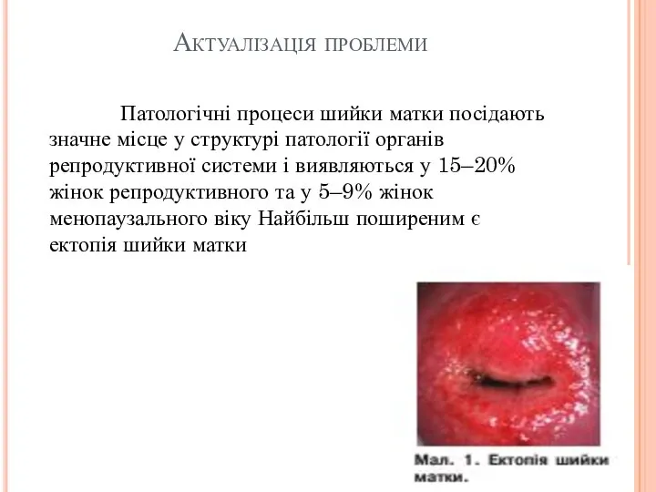 Патологічні процеси шийки матки посідають значне місце у структурі патології органів репродуктивної