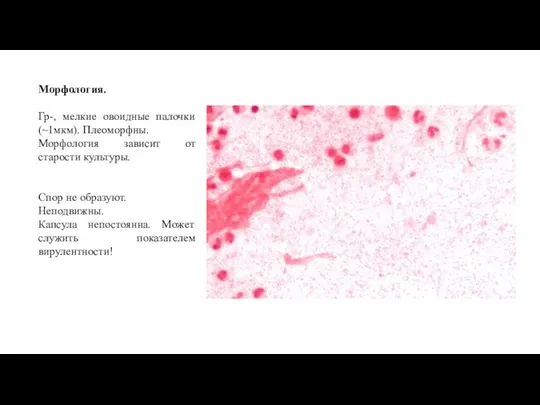 Морфология. Гр-, мелкие овоидные палочки (~1мкм). Плеоморфны. Морфология зависит от старости культуры.