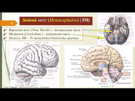 Задний мозг (Metencephalon) (ЗМ) Варолиев мост (Pons Warolii ) - вентральная часть