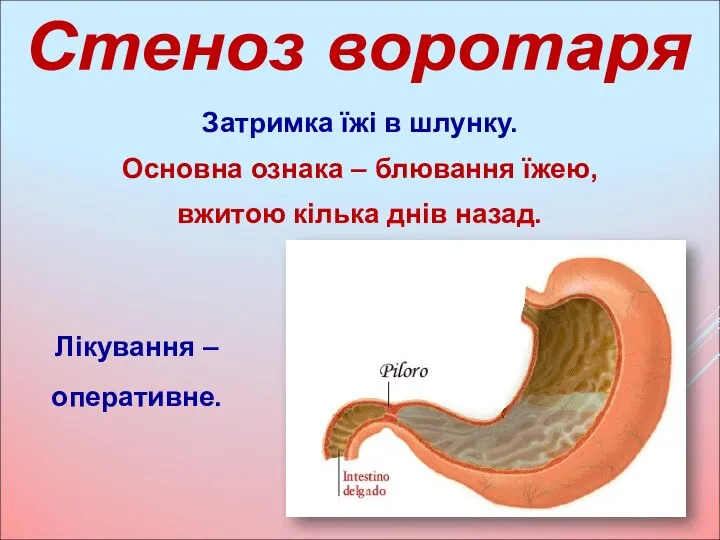 Затримка їжі в шлунку. Основна ознака – блювання їжею, вжитою кілька днів